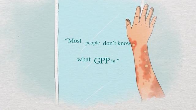 generalized pustular psoriasis graphic